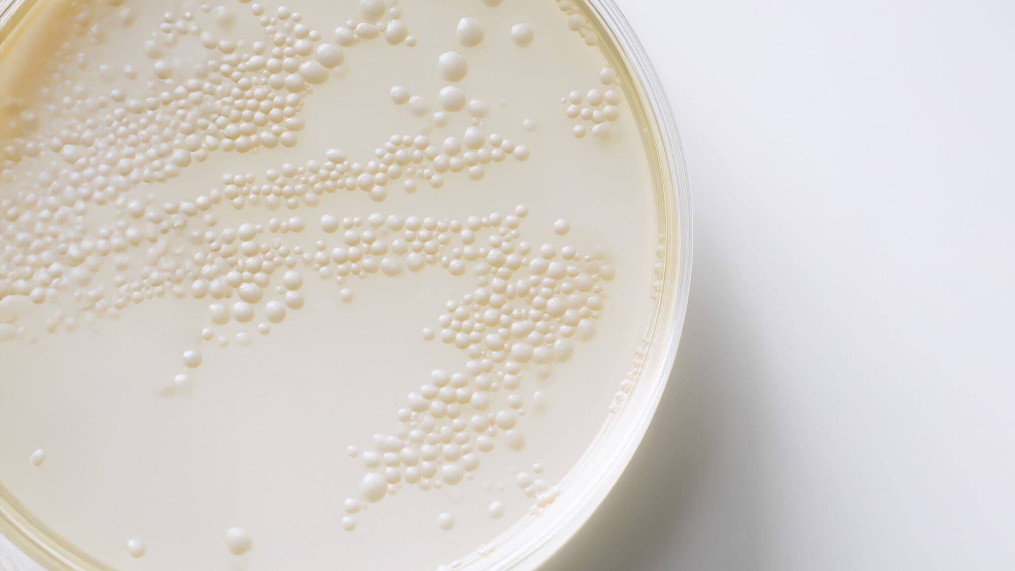 Petrischale mit gelblicher Flüssigkeit, KI-generiert